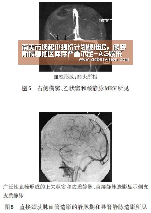 南美市场松木提价计划被推迟,俄罗斯秋娜地区库存严重不足-AG娱乐(图4) AG电竞